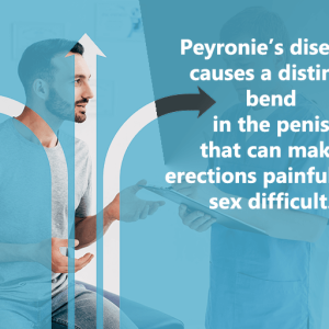 Peyronie's disease causes a distinct bend in the penis that can make erections painful and sex difficult.