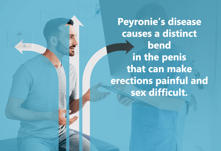Do penis extenders really work for straightening penile curvature