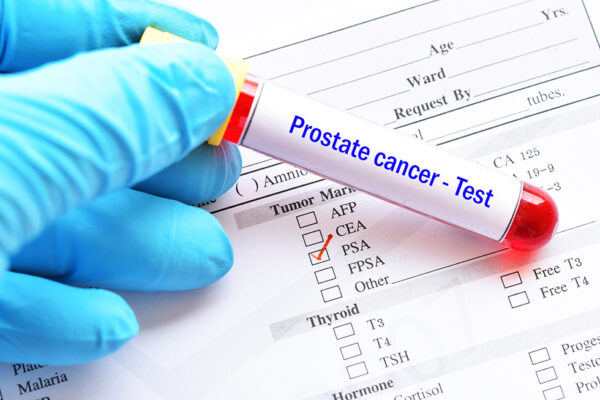 Blood sample tube with lab requisition form for PSA test